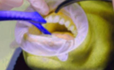 ����ӛ�����x15ƪ��